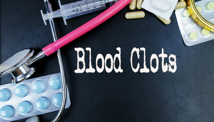 Blood Clotting Disorders – Symptoms, Causes, and More