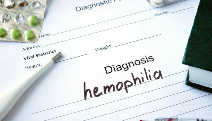 Hemophilia – Symptoms, Types, and Management Options