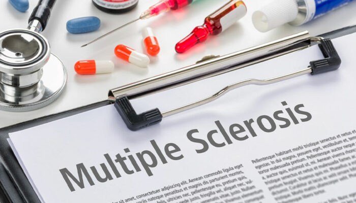 Multiple Sclerosis – Types, Diagnosis and Management Options
