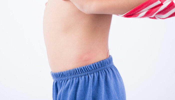 10 common types of skin rashes you should be aware of