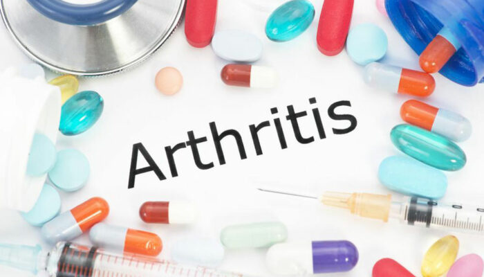Arthritis – Classification and treatment