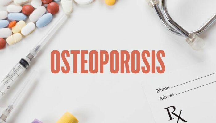 Bone density testing – An important diagnostic tool for osteoporosis