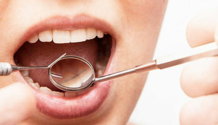 Here are solutions to 3 common issues of the lower denture