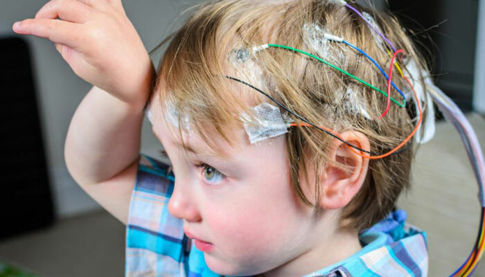 Here’s how you can help someone undergoing an epileptic seizure