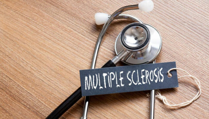 Multiple sclerosis – Things you need to know
