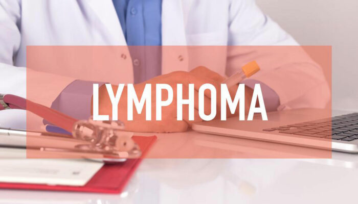 Non Hodgkin Lymphoma treatment – Symptoms, causes and more explained