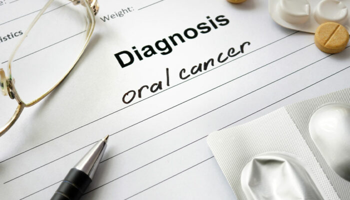 Oral Cancer – Symptoms, Causes and Management Options