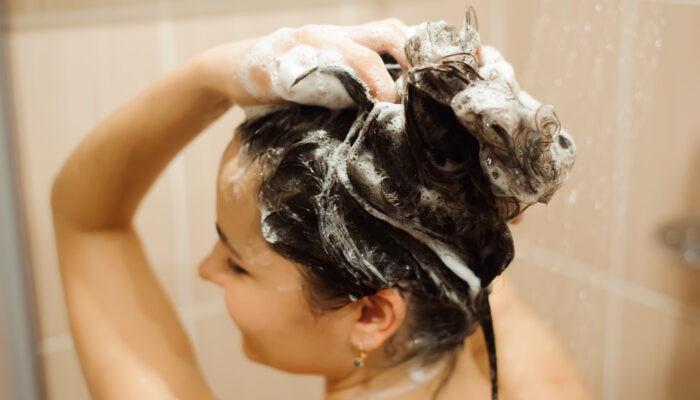 Scalp Psoriasis – Symptoms, Causes, and Effective Shampoos
