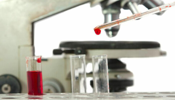 WBC count – Understanding the blood count