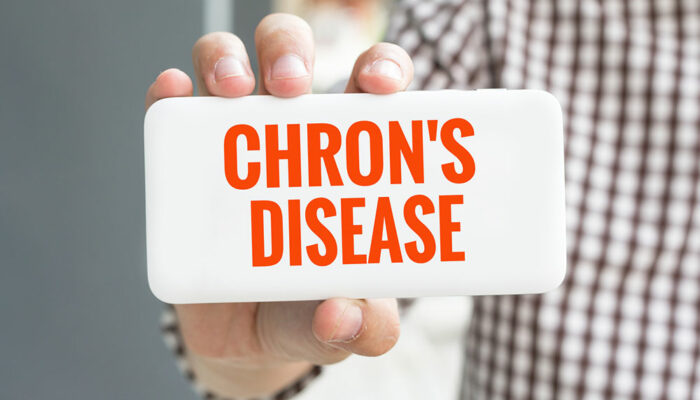 All You Need to Know about Chron’s disease