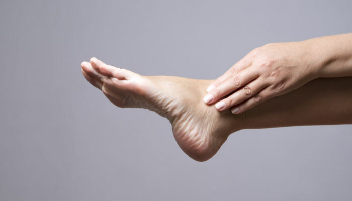 Bottom of Foot Pain – Causes, Symptoms, and Diagnosis