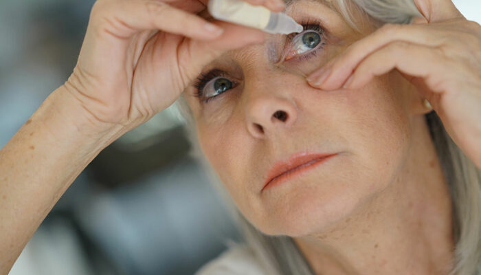 Dry eyes – Symptoms, causes, and treatment