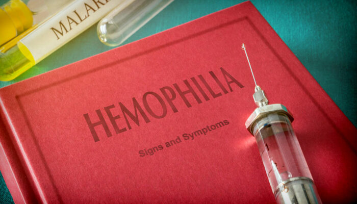 Hemophilia – 4 main symptoms and their severity