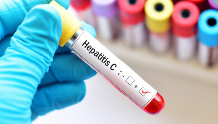Hepatitis – types and contributing factors