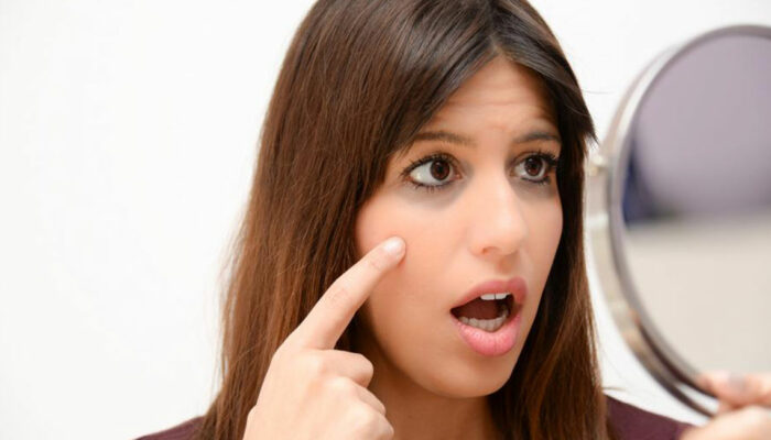 Here’s How to Fix Your Dark Circles Like a Pro