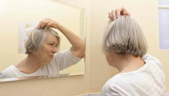 Thinning Hair Solutions – Watch Out Before It Is Too Late