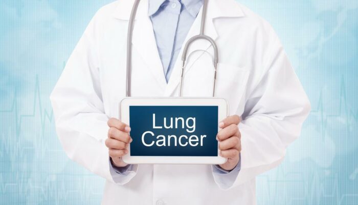Treatments for Lung Cancer