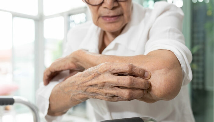 Itchy Skin in Seniors – Causes, Symptoms, and Management